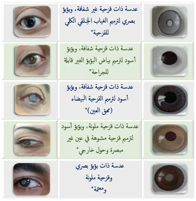 أشكال العدسات الترميمية