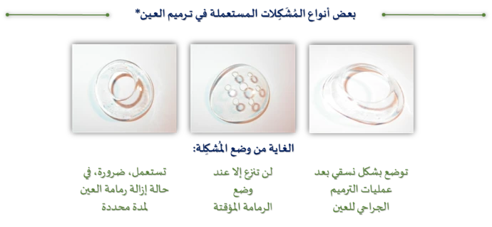 المشكلات
