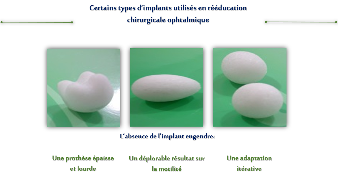 Certains types d'implants utilisés en rééducation chirurgicale ophtalmique